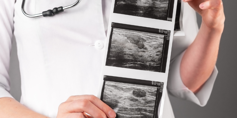 ultrazvuk dojki podgorica